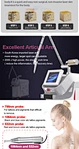 Q Switched Laser Yag Tattoo Removal